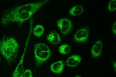Image of live cells incubated with the polymer nanoparticles.
