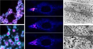 researchers-identify-a-novel-disease-gene-causing-neurodegenerative-disorders-bio_presentation.jpg